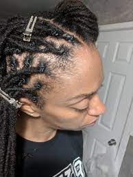 What is postpartum hair loss? - OrganiGrowHairCo
