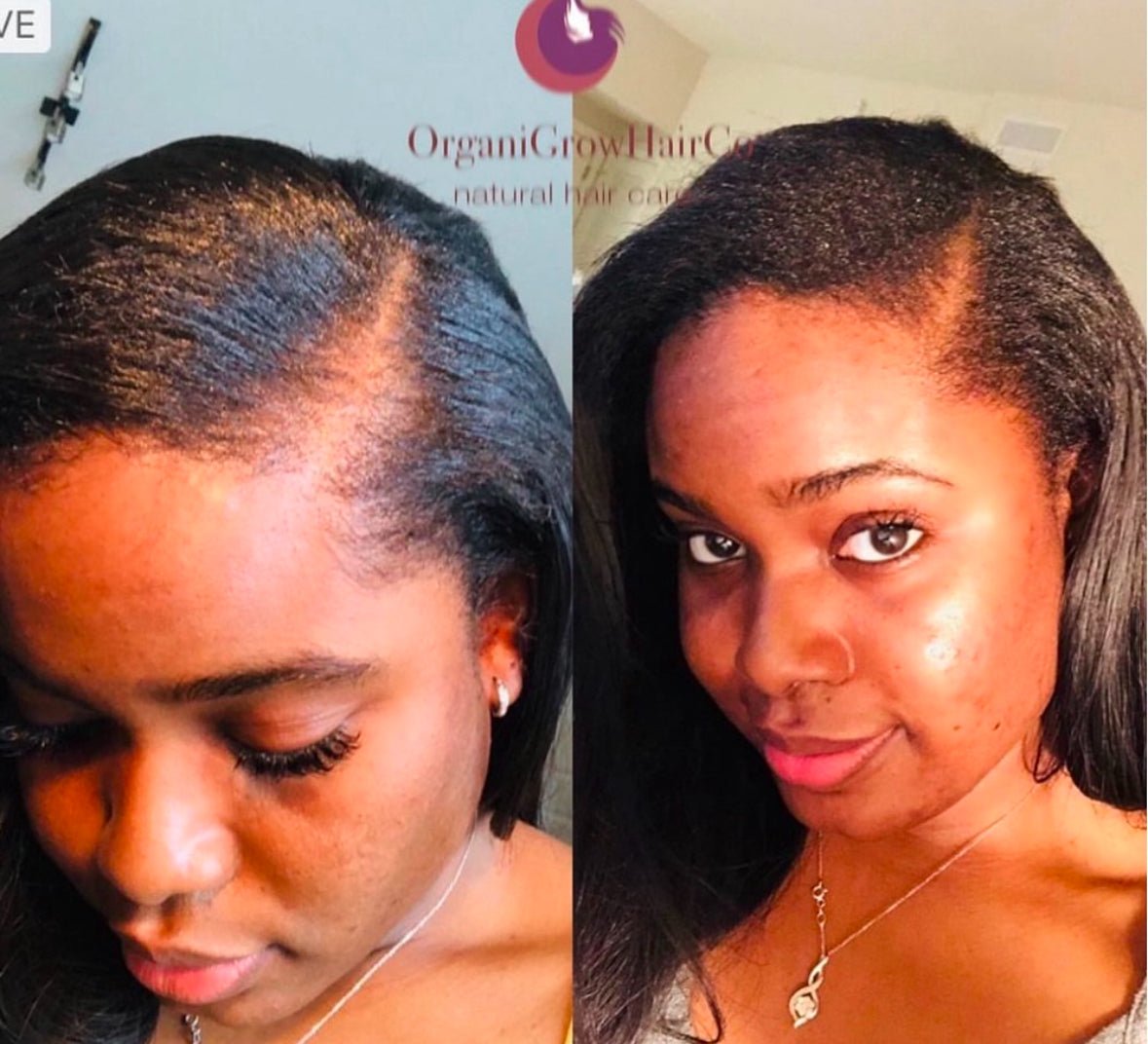 Grow Diamond Bundle (Low Porosity) Bundles OrganiGrowHair Co