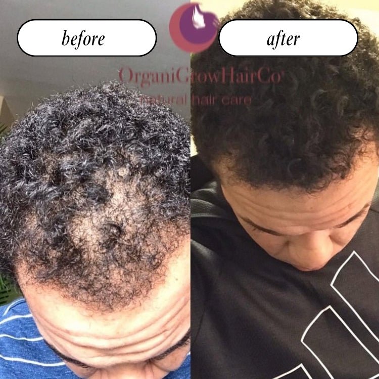 Grow Gold Bundle (Low Porosity) Bundles OrganiGrowHair Co