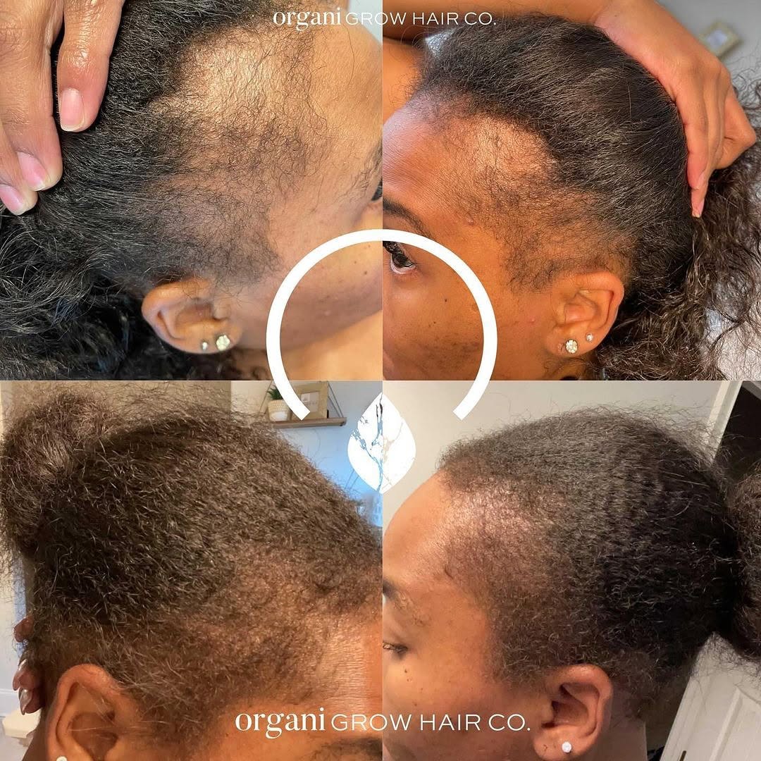 Stimulating Scalp Beverage – High with Black Seed Oil - Hair Growth Oil OIL OrganiGrowHair Co