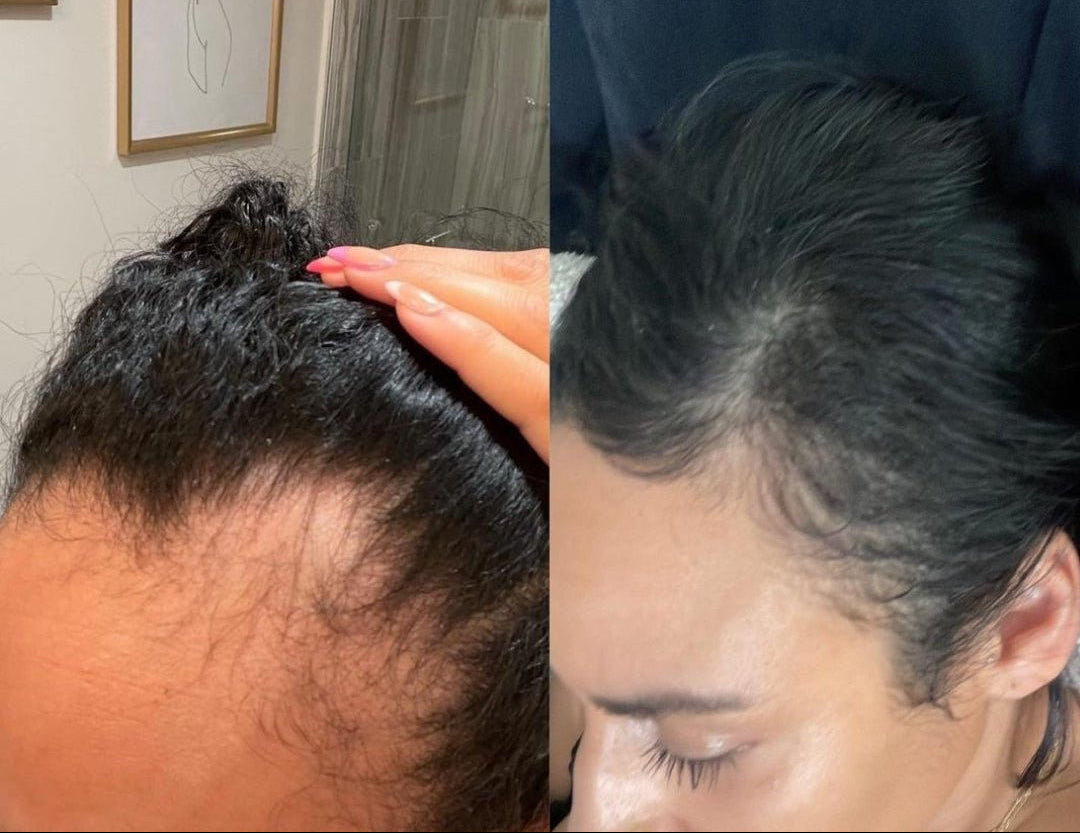 Stimulating Scalp Beverage – High with Black Seed Oil - Hair Growth Oil OIL OrganiGrowHair Co