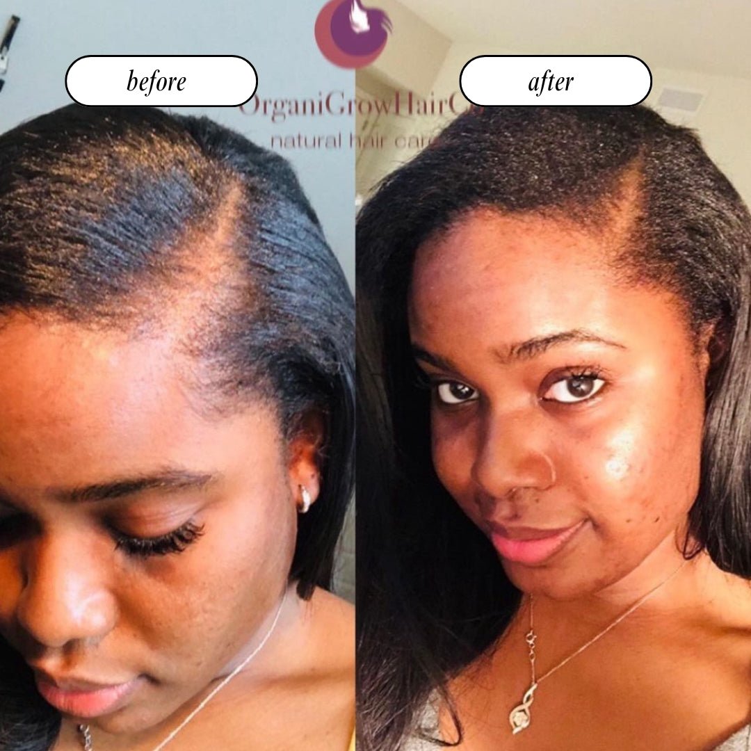 Stimulating Scalp Beverage LOW POROSITY WITH BLACK SEED OIL - HAIR GROWTH OIL OIL OrganiGrowHairCo