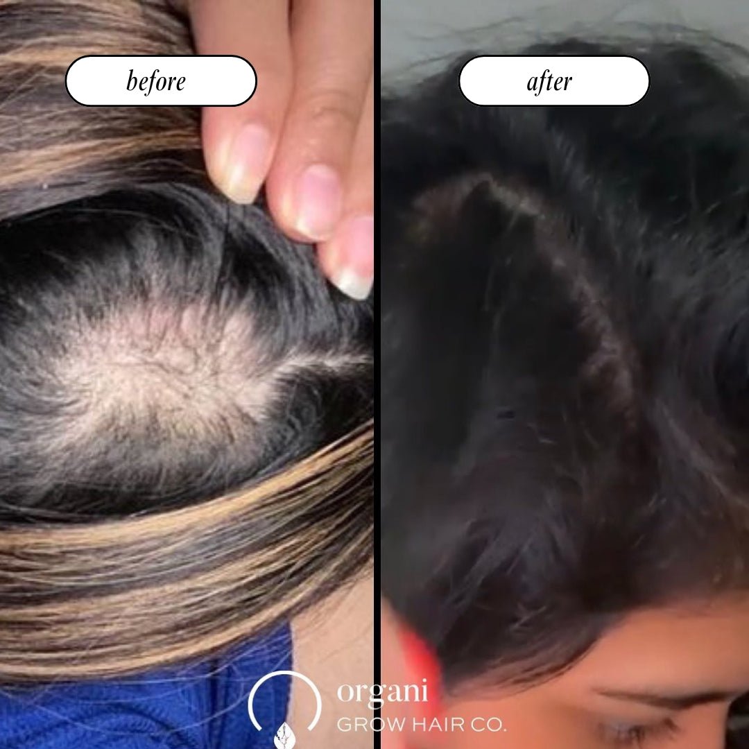 Stimulating Scalp Beverage LOW POROSITY WITH BLACK SEED OIL - HAIR GROWTH OIL OIL OrganiGrowHairCo