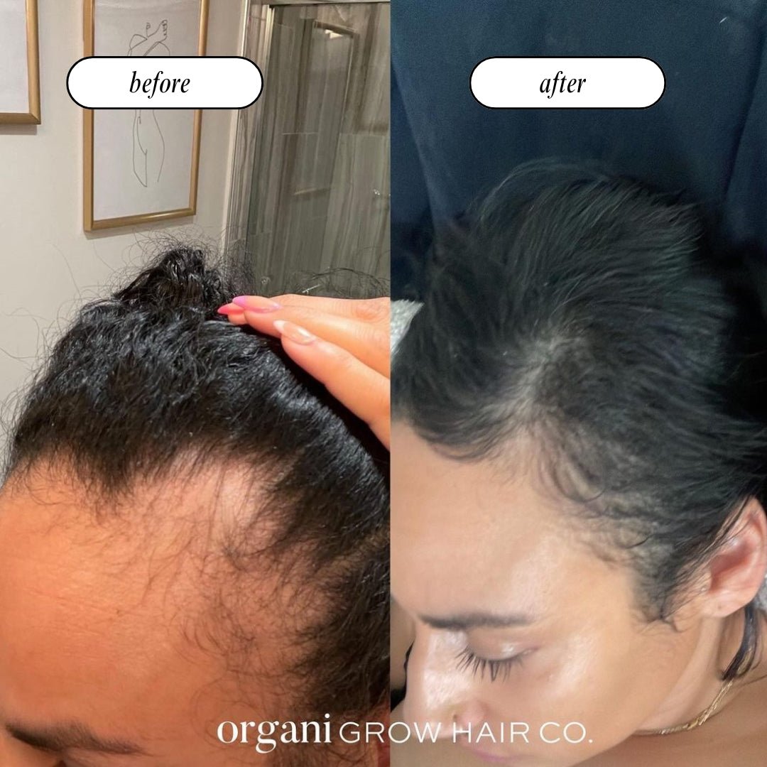 Stimulating Scalp Beverage LOW POROSITY WITH BLACK SEED OIL - HAIR GROWTH OIL OIL OrganiGrowHairCo