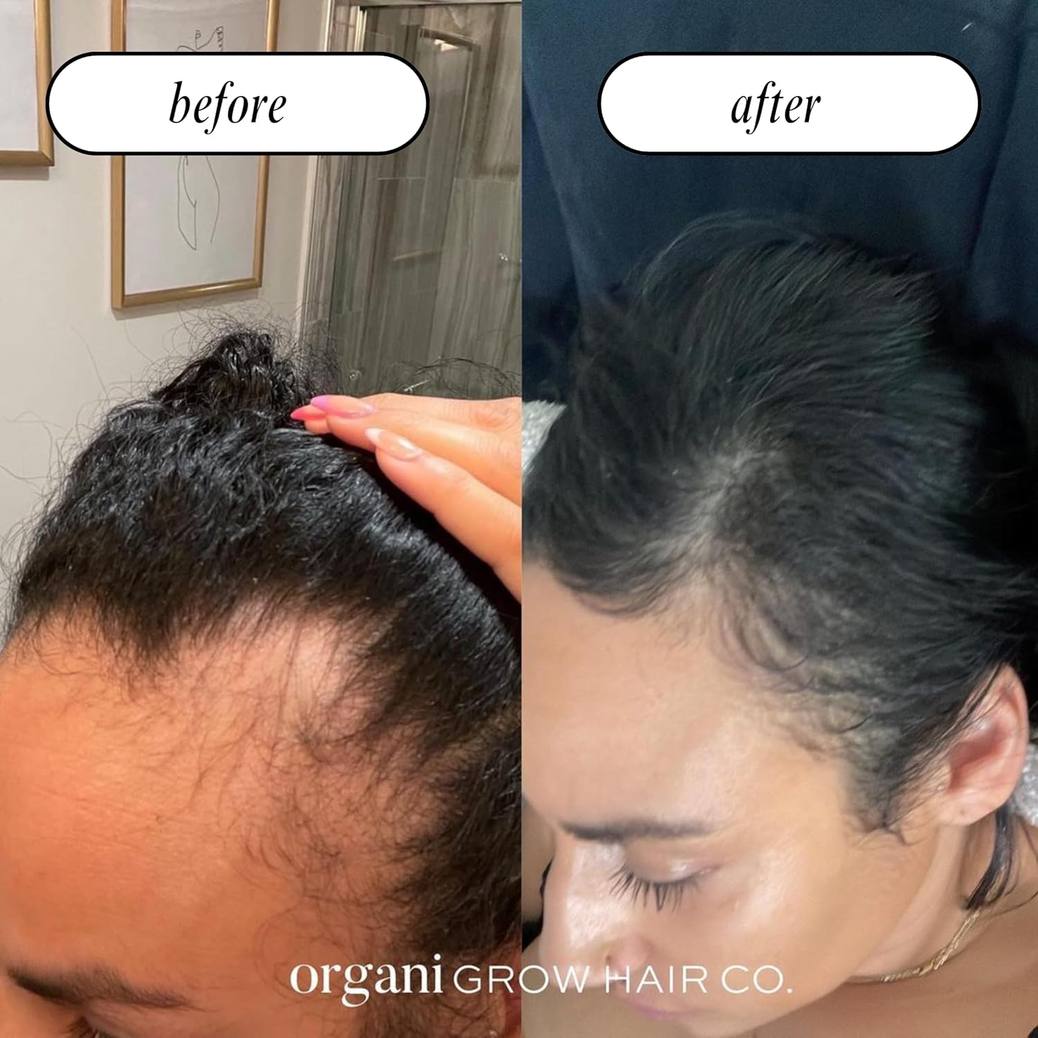 Grow N Glow Hair Skin Nails Anti Aging Multivitamins SKIN CARE OrganiGrowHairCo