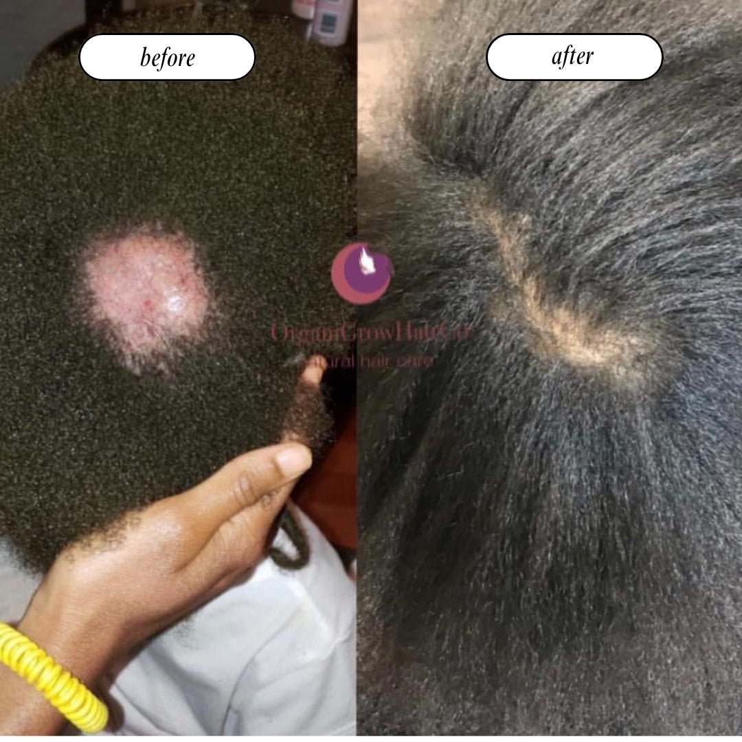 Grow Gold Bundle (Low Porosity) Bundles OrganiGrowHair Co