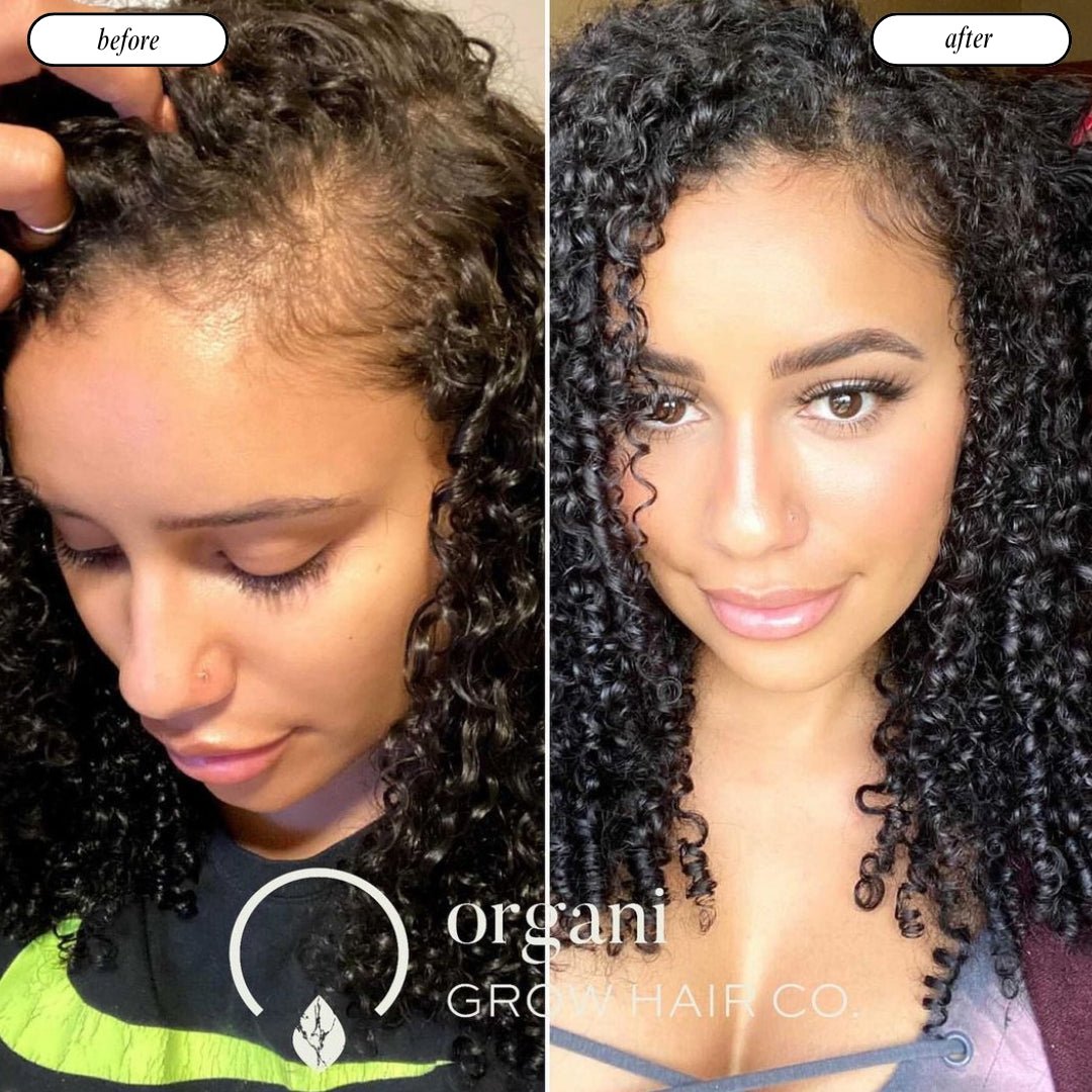 Grow Gold Bundle (Low Porosity) Bundles OrganiGrowHair Co