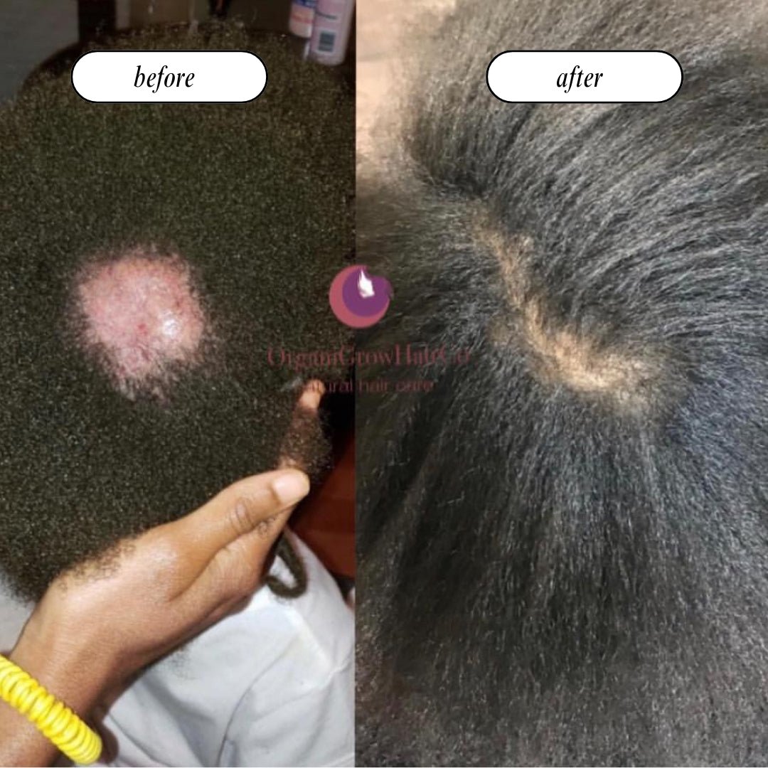 Stimulating Scalp Beverage LOW POROSITY WITH BLACK SEED OIL - HAIR GROWTH OIL OIL OrganiGrowHairCo