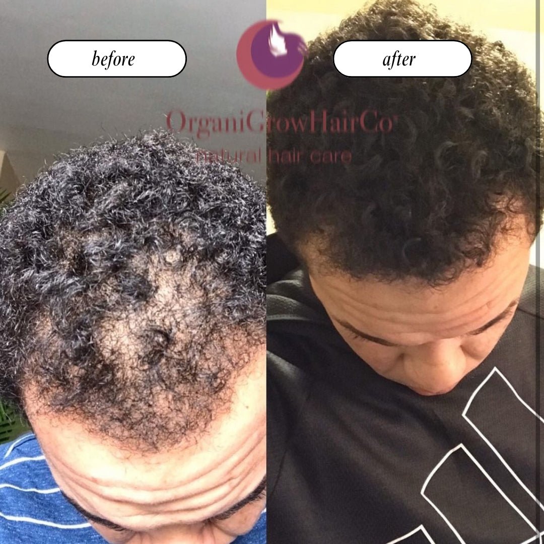 Stimulating Scalp Beverage LOW POROSITY WITH BLACK SEED OIL - HAIR GROWTH OIL OIL OrganiGrowHairCo