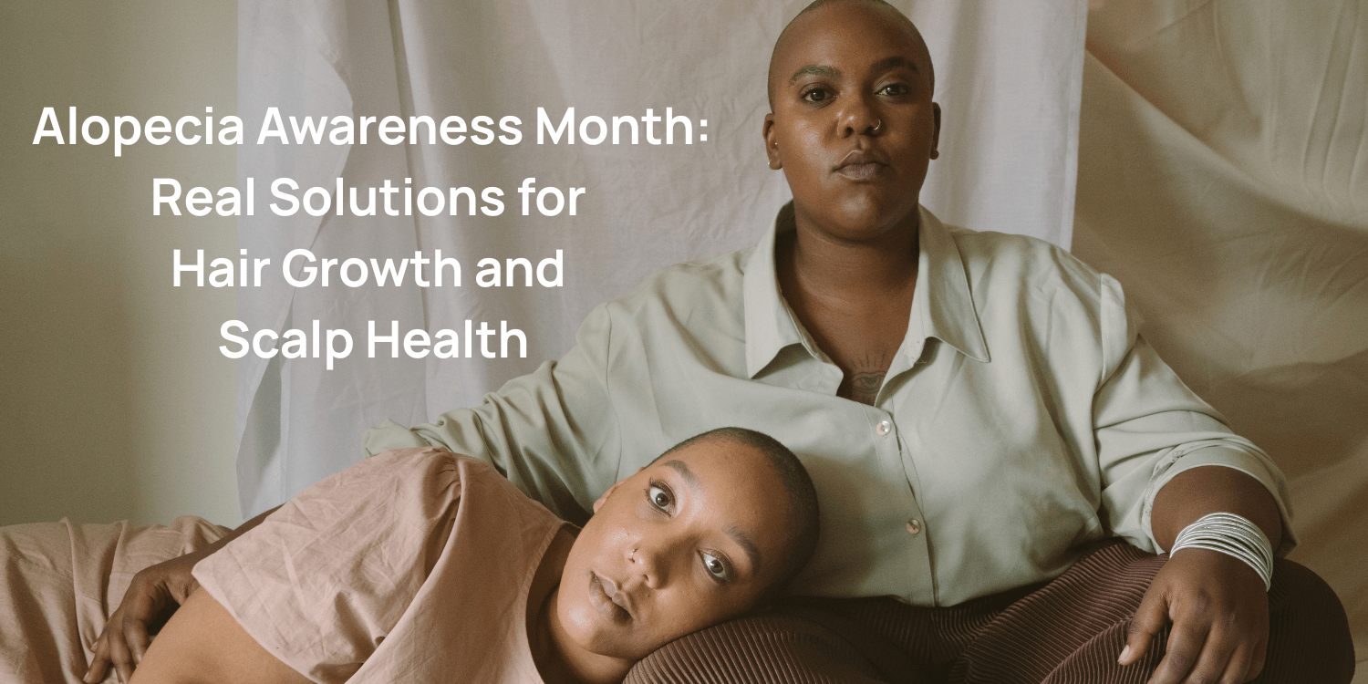 Alopecia Awareness Month: Natural Hair Growth Solutions Since 2016 - OrganiGrowHairCo