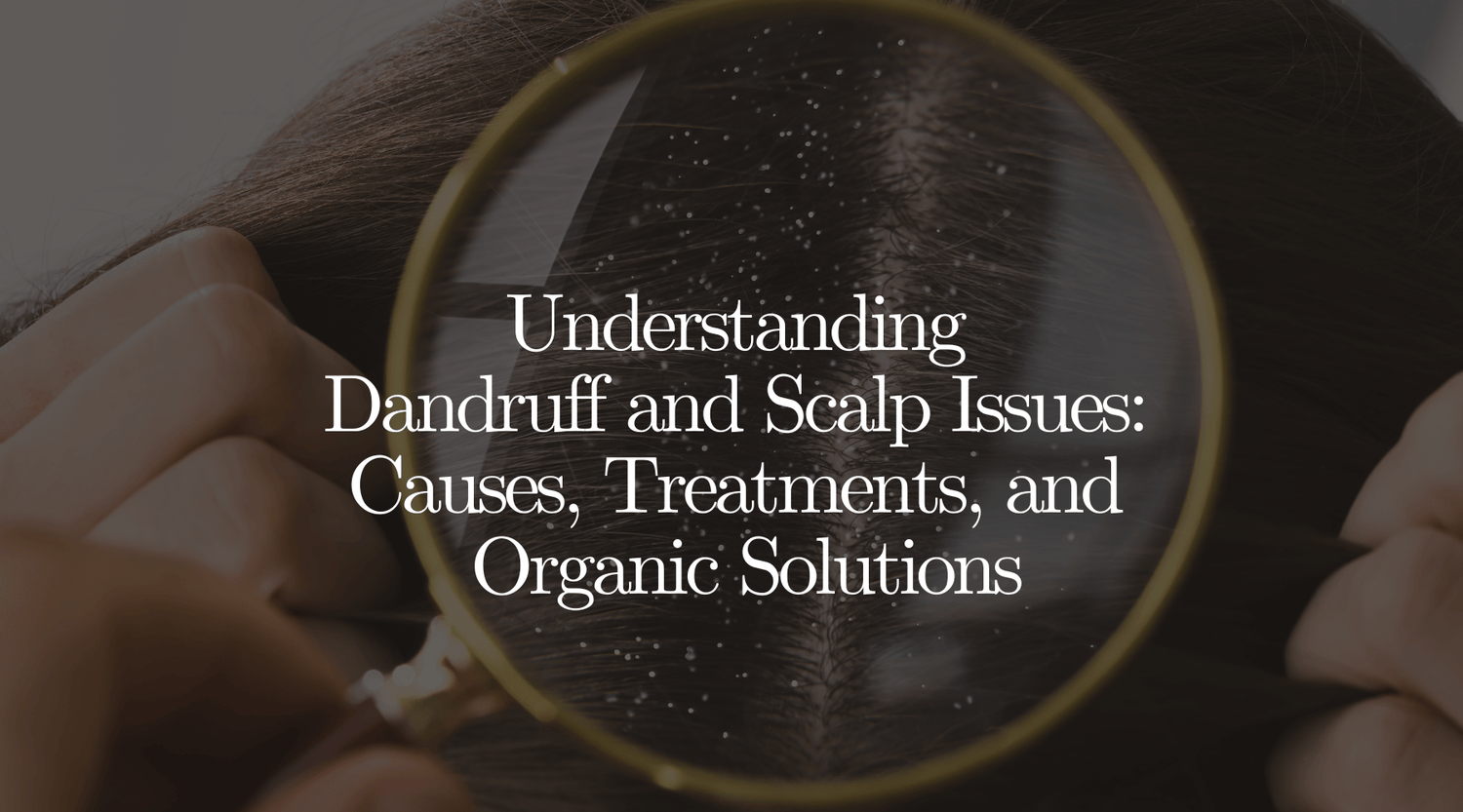 Understanding Dandruff and Scalp Issues: Causes, Treatments, and Organic Solutions - OrganiGrowHairCo