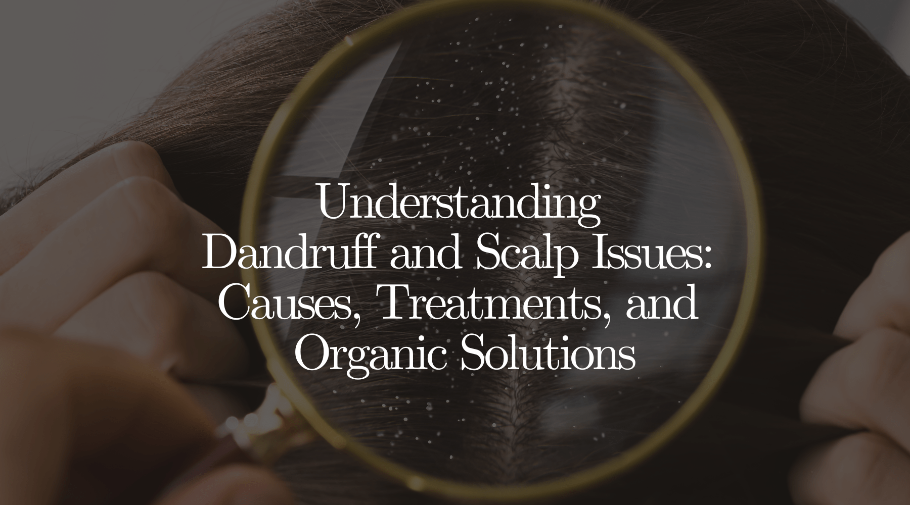 Understanding Dandruff and Scalp Issues: Causes, Treatments, and Organic Solutions - OrganiGrowHairCo