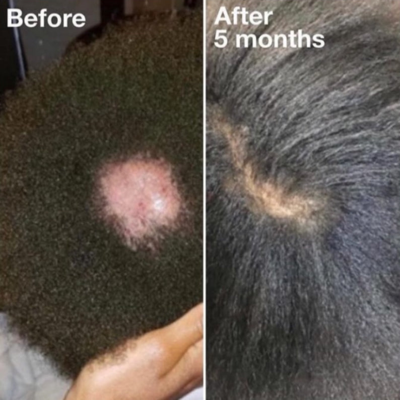 Natural hair growth products for April 2026 - OrganiGrow organic botanicals