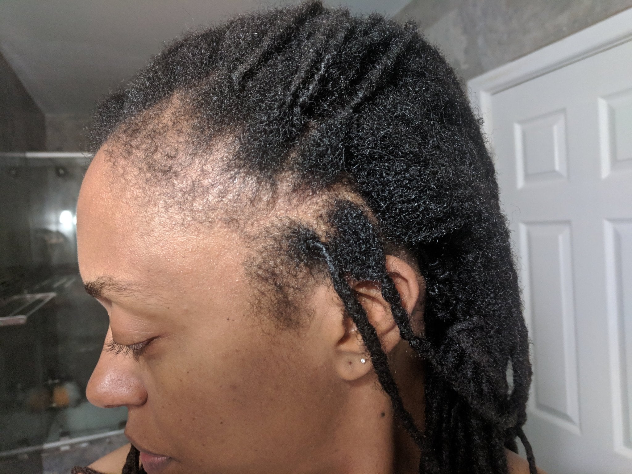 What is Postpartum Hair Loss? - OrganiGrowHairCo