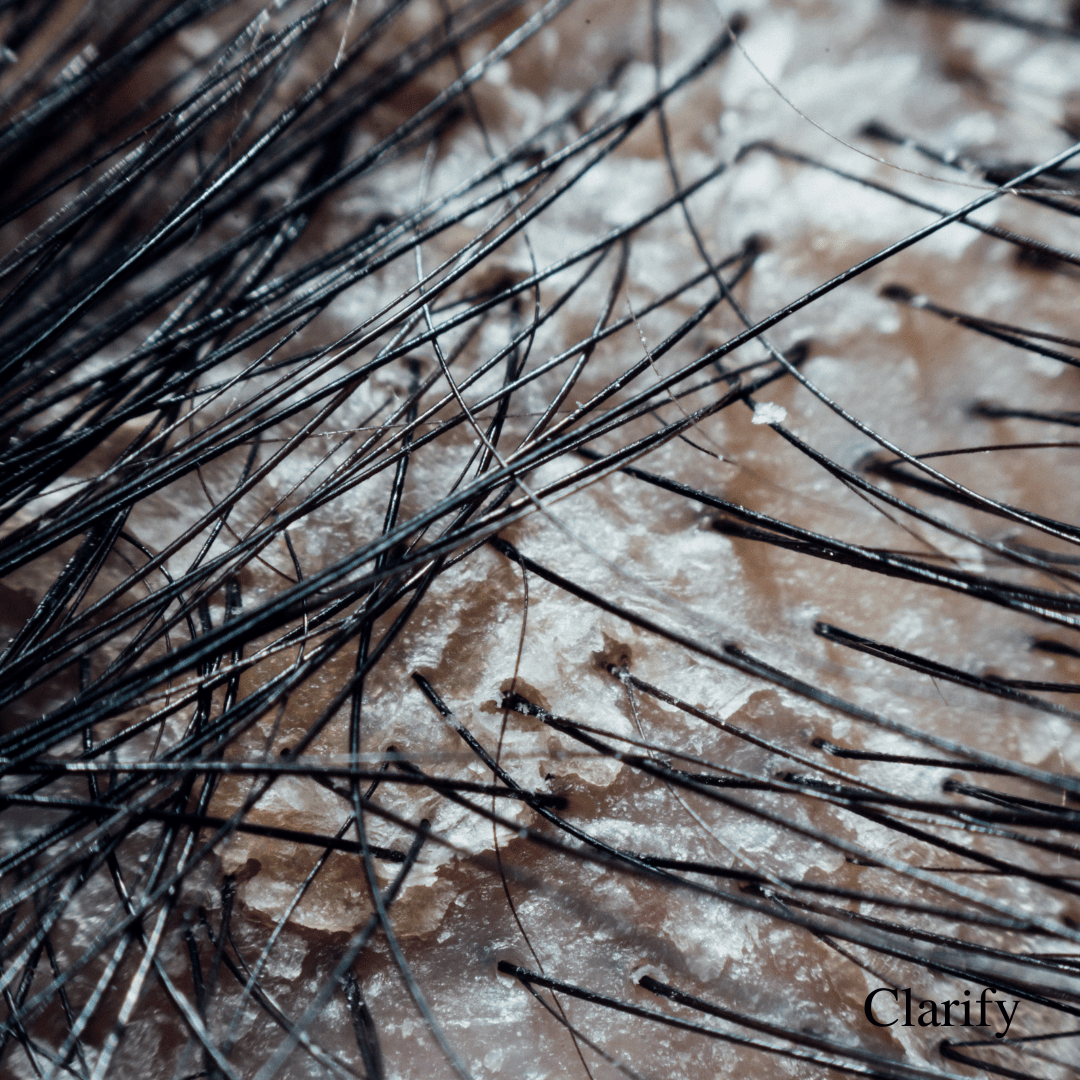 Hair and Scalp Reset Button - OrganiGrowHairCo