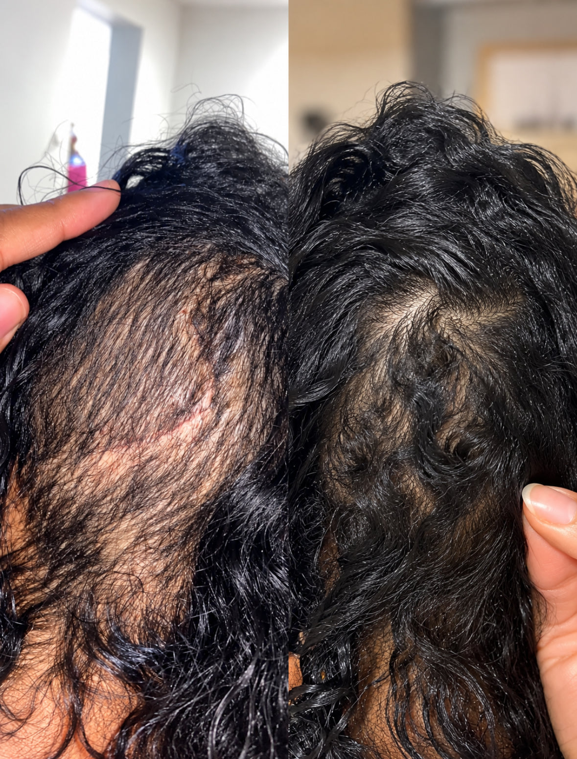 She Had to Shave Her Hair. Here’s the Story She Shared Next.