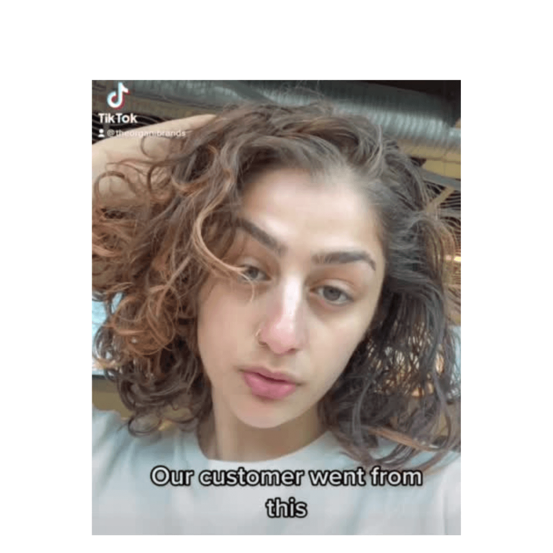Extreme Recovery From Alopecia - OrganiGrowHairCo