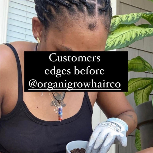 Grow Your Edges and Win Product - OrganiGrowHairCo