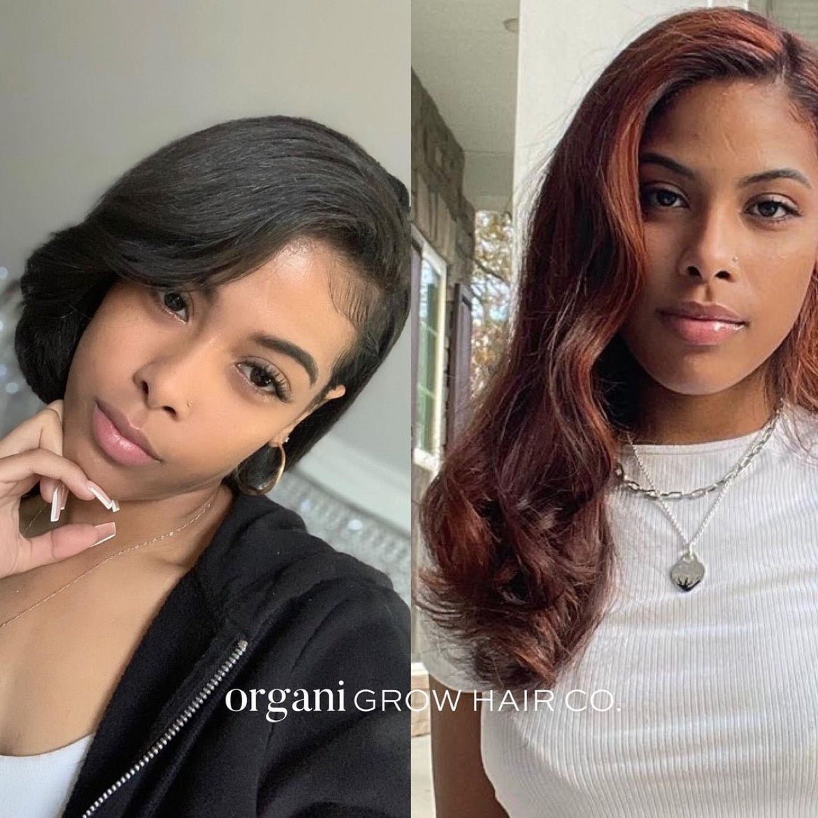 Heal and grow your hair while winning free product - OrganiGrowHairCo