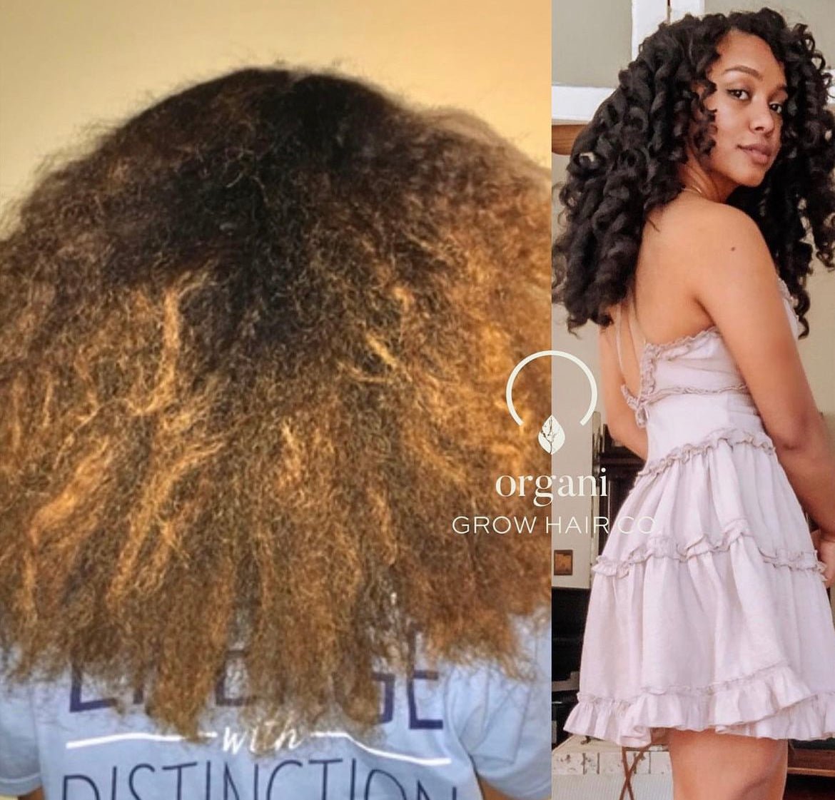 Heal & Regrow Hair Naturally - OrganiGrowHairCo
