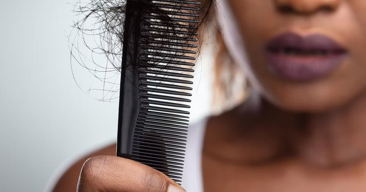 HOW MUCH HAIR LOSS IS NORMAL? - OrganiGrowHairCo