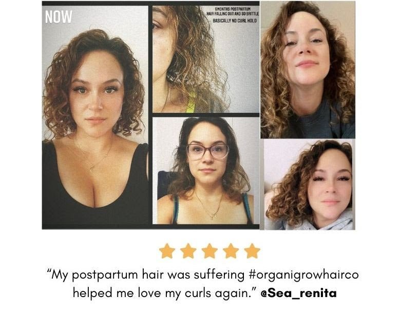 Postpartum Hair Shedding, Thinning and Breakage - OrganiGrowHairCo