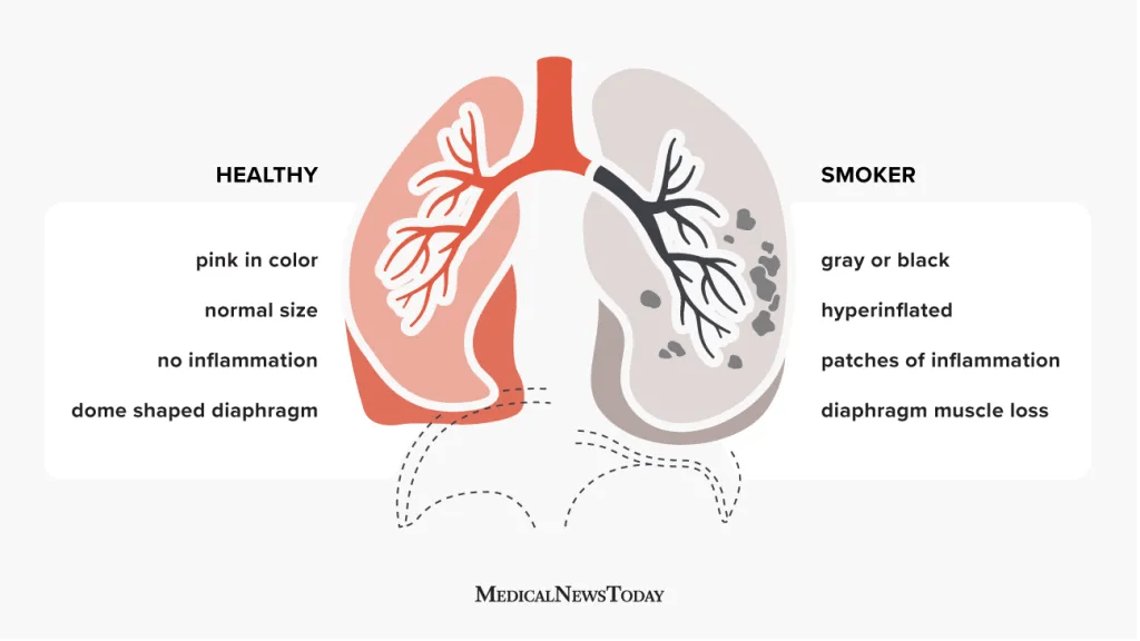 Protect Your Lungs Naturally - OrganiGrowHairCo