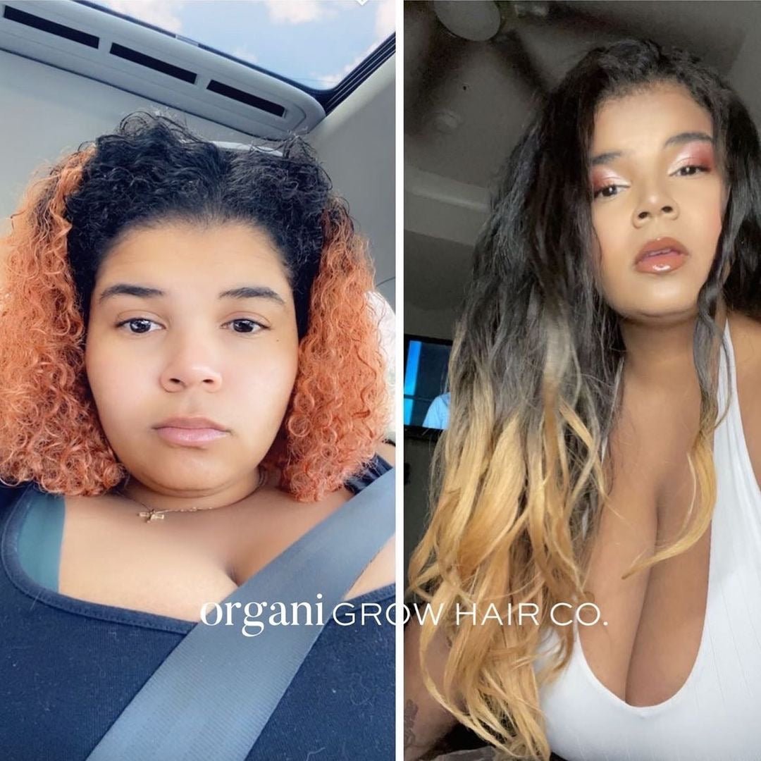 Testimony Winner - OrganiGrowHairCo