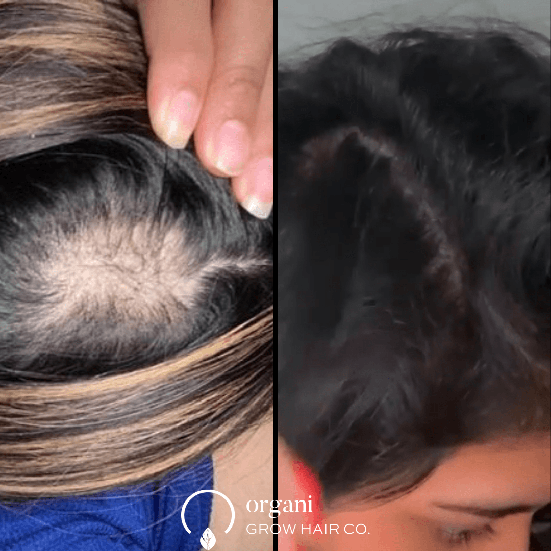 Testimony Winner TheOrganiBrands products changed my life - OrganiGrowHairCo