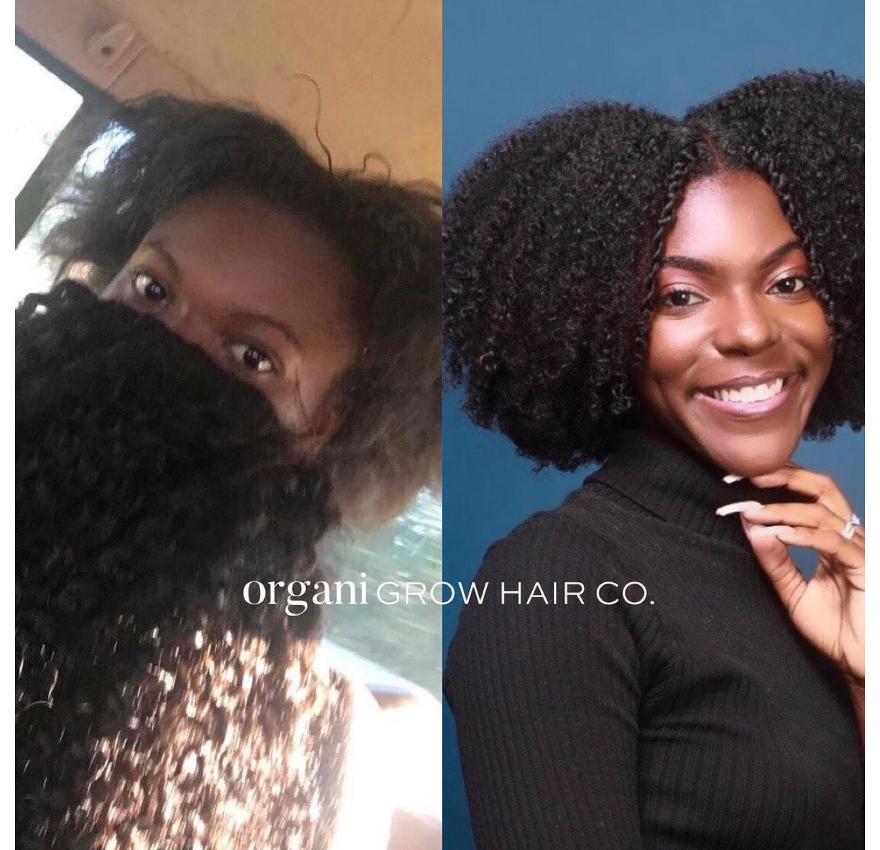Win a FREE Product! - OrganiGrowHairCo