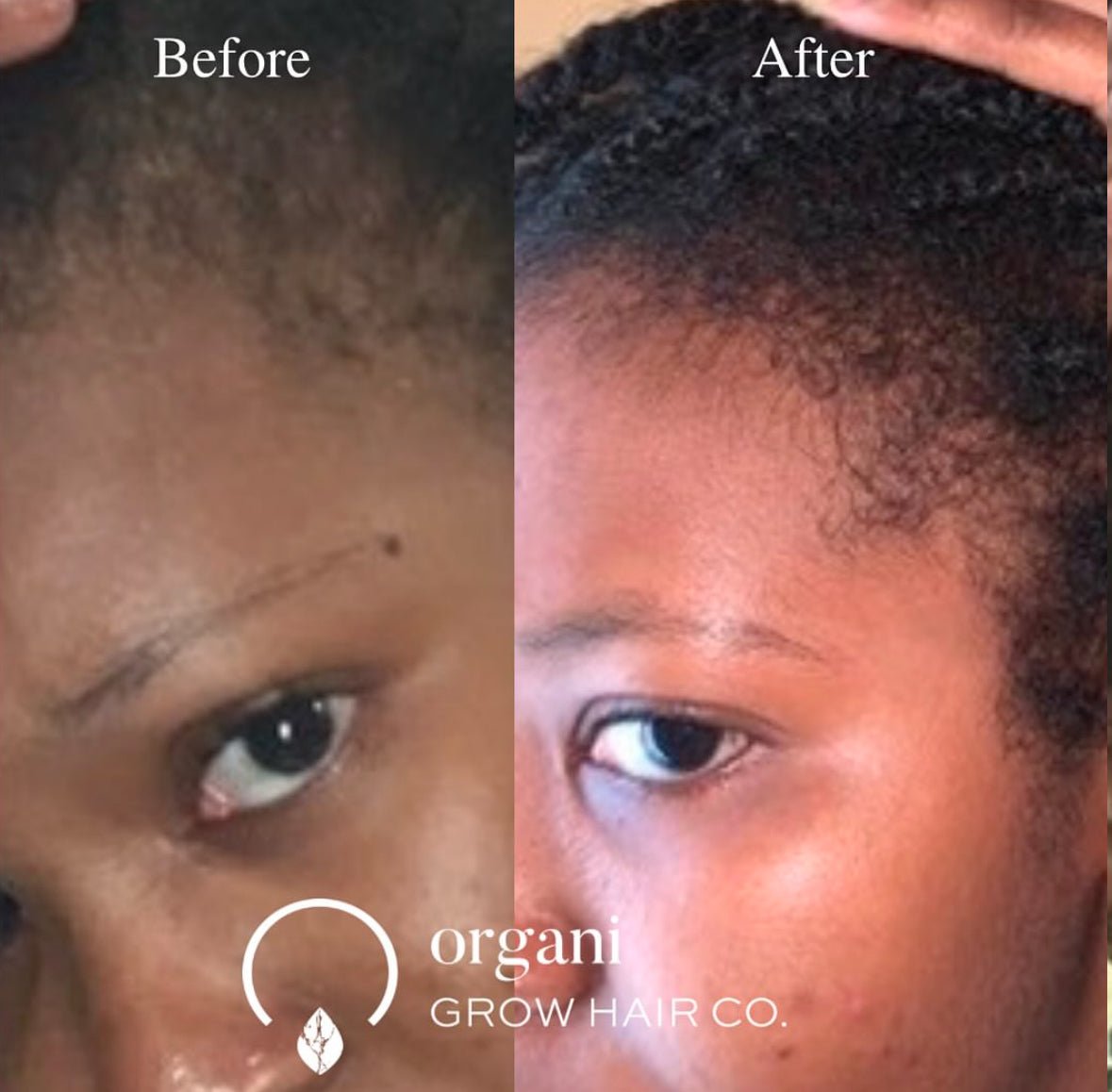 Grow Diamond Bundle (Low Porosity) Bundles OrganiGrowHair Co