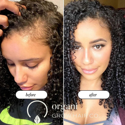 Stimulating Scalp Beverage - Medium Porosity with Black Seed Oil - Hair Growth Oil OIL OrganiGrowHair Co