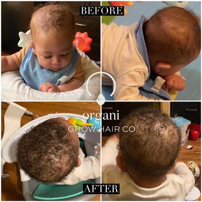 Stimulating Scalp Beverage - Medium Porosity with Black Seed Oil - Hair Growth Oil OIL OrganiGrowHair Co