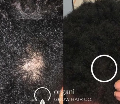 Grow Gold Bundle (Low Porosity)