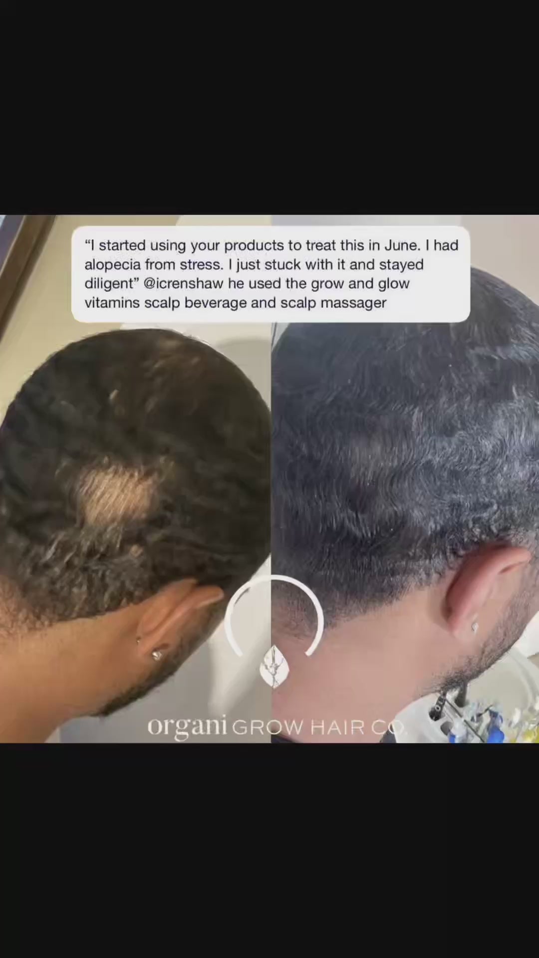 GrowPoo Clarifying Shampoo